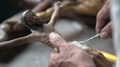 Embedded thumbnail for Clínica de Santos &gt; Videos