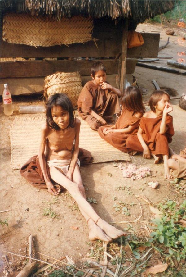 Población asháninka enferma por desnutrición