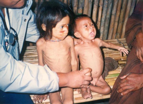 Población asháninka enferma por desnutrición