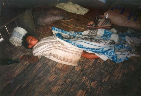 Población asháninka enferma por desnutrición