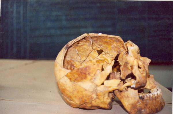 Limpieza e identificación de restos hallados en las fosas de Chuschi - Ayacucho