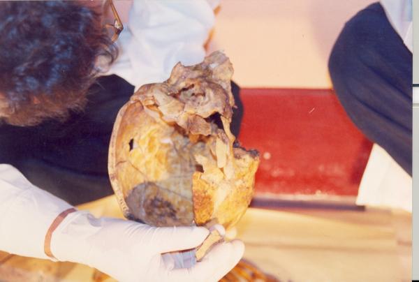 Limpieza e identificación de restos hallados en las fosas de Chuschi - Ayacucho