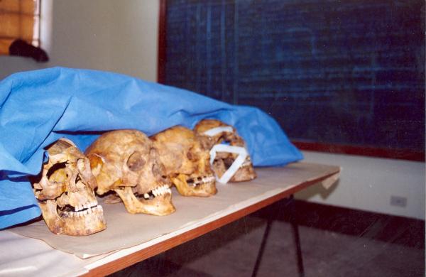 Limpieza e identificación de restos hallados en las fosas de Chuschi - Ayacucho